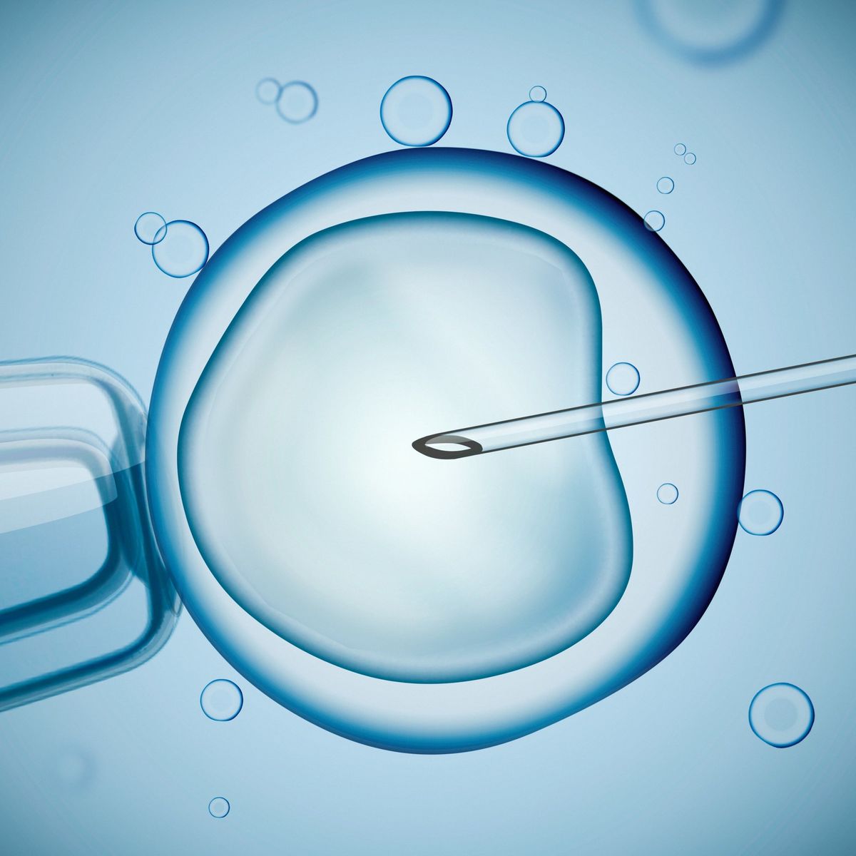 IVF Treatment for International Patients in Gurgaon