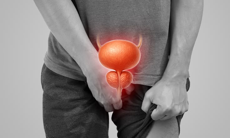 Prostate Cancer Treatment in Gurgaon